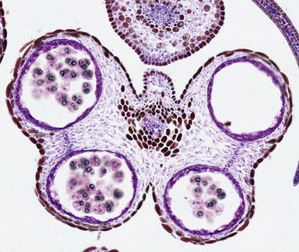 Developing pollen grains in a Chrysanthemum flower bud, LM