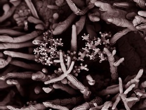 view Fungal spores on the surface of a fig, SEM