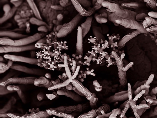 Fungal spores on the surface of a fig, SEM
