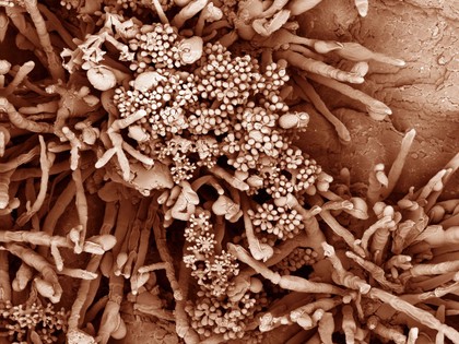 Fungal spores on the surface of a fig, SEM