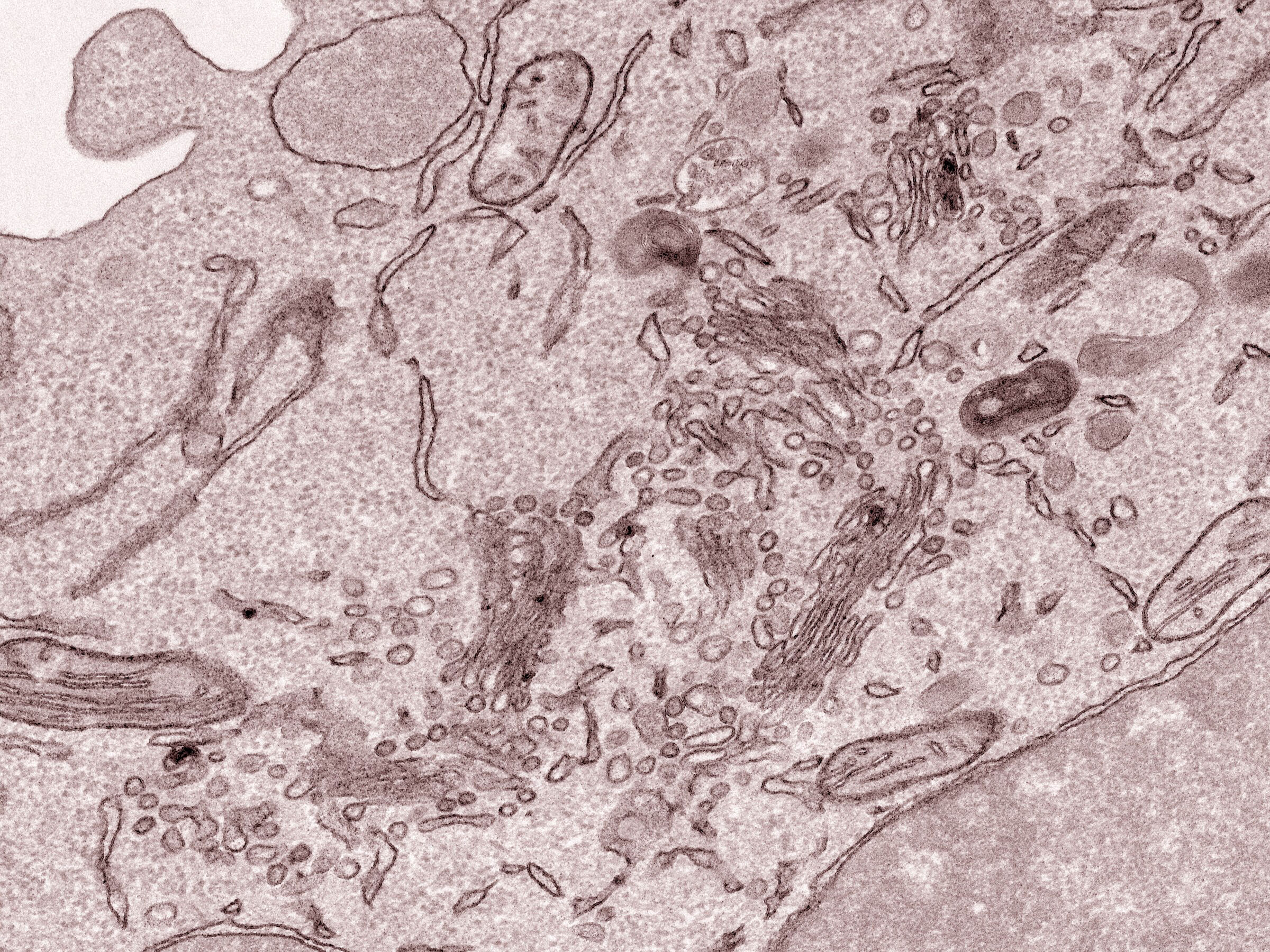 Ultrastructure inside a macrophage cell, TEM | Wellcome Collection