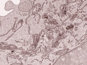 view Ultrastructure inside a macrophage cell, TEM