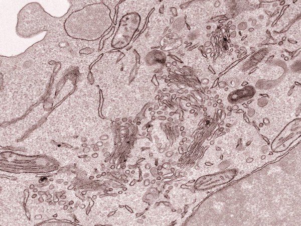 Ultrastructure inside a macrophage cell, TEM