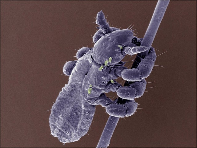 Head louse clinging to strand of human hair, SEM