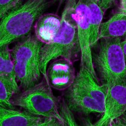 Dividing HeLa cells, LM