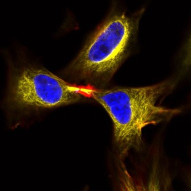 Dividing HeLa cells, LM