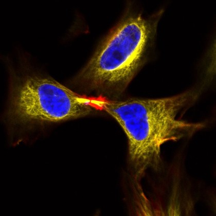 Dividing HeLa cells, LM
