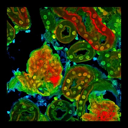Mouse kidney