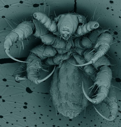 Head louse, SEM