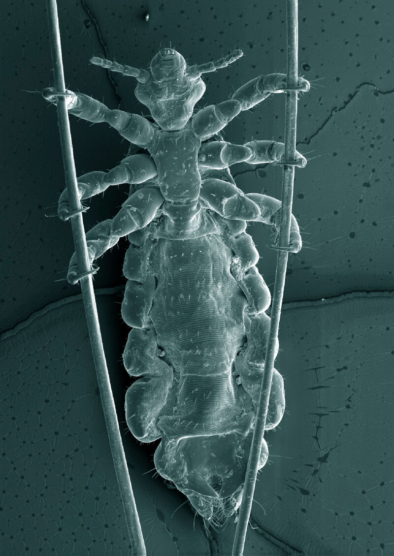 lice under microscope