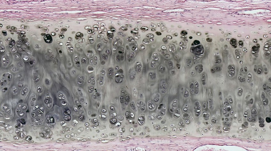Human nasal septum, LM