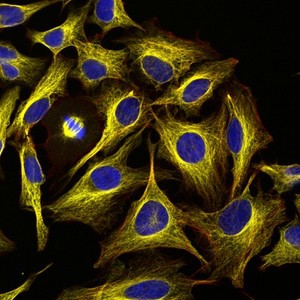 view HeLa cells, LM