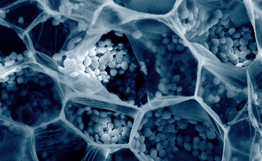 Raw ginger, SEM