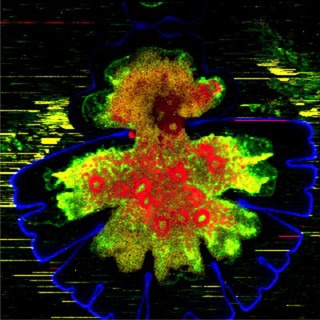 Desmid Micrasterias denticulata undergoing cell division