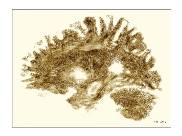 Healthy adult human brain, tractography from MRI.