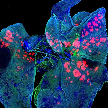 Drug-releasing depots in mouse lungs.