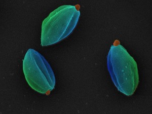 view Leishmania mexicana parasites in the amastigote stage, SEM