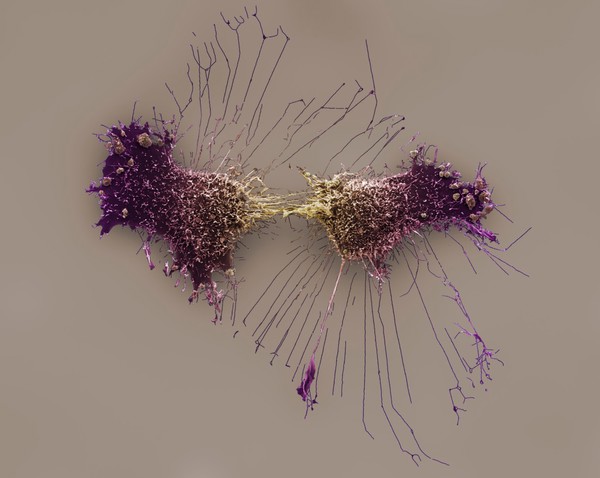 HeLa cells, immortal human epithelial cancer cell line, SEM