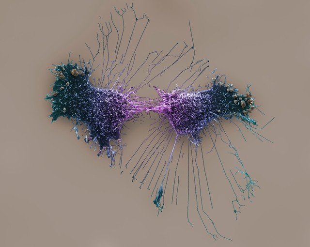 HeLa cells, immortal human epithelial cancer cell line, SEM