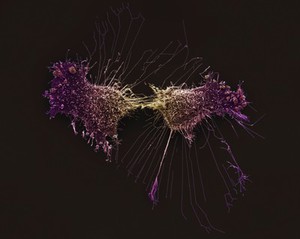 view HeLa cells, immortal human epithelial cancer cell line, SEM