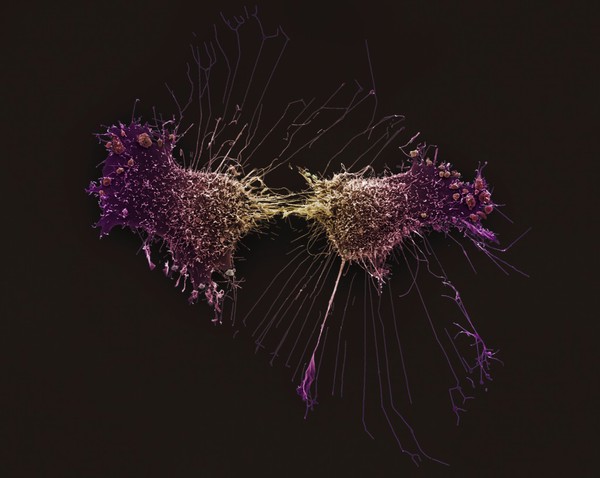 HeLa cells, immortal human epithelial cancer cell line, SEM