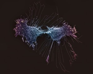 view HeLa cells, immortal human epithelial cancer cell line, SEM