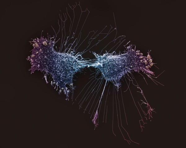 HeLa cells, immortal human epithelial cancer cell line, SEM