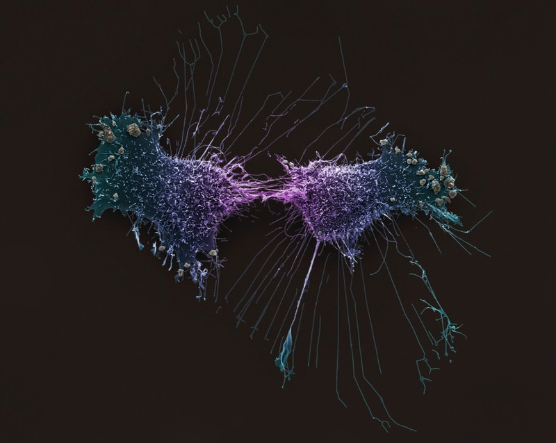 HeLa Cells Immortal Human Epithelial Cancer Cell Line SEM Wellcome