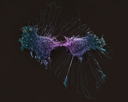 HeLa cells, immortal human epithelial cancer cell line, SEM