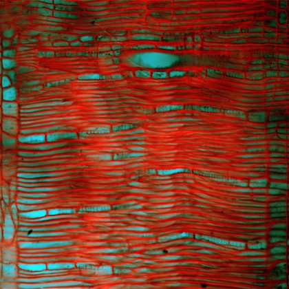 Plant tissue, LM