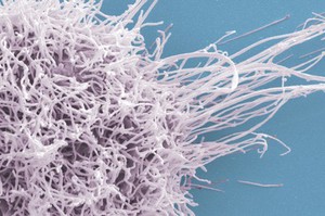 view HeLa cell, immortal human epithelial cancer cell line, SEM