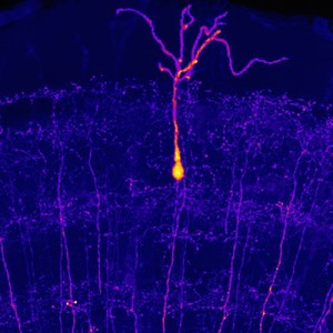 view Single neurone in the midbrain of an adult zebrafish, LM