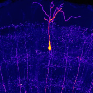 Single neurone in the midbrain of an adult zebrafish, LM