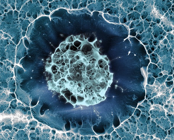 Human stem cell embedded in a 3D matrix, Cryo SEM.