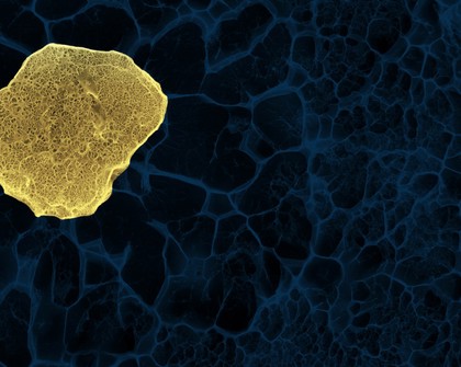 Human stem cell embedded in a 3D matrix, Cryo SEM