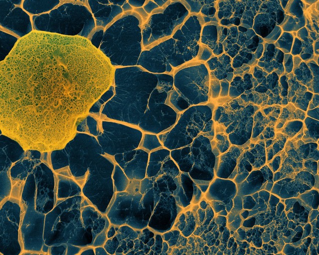 Human stem cell embedded in a 3D matrix, Cryo SEM