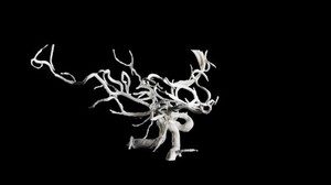 view Brain blood vessels, suspected meningitis, 3D printed nylon