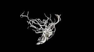 view Brain blood vessels, suspected meningitis, 3D printed nylon