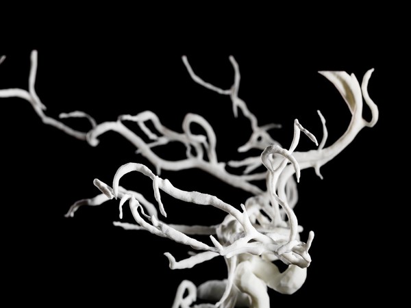 Brain blood vessels, suspected meningitis, 3D printed nylon