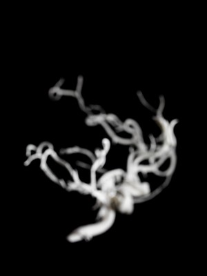 view Brain blood vessels, suspected meningitis, 3D printed nylon