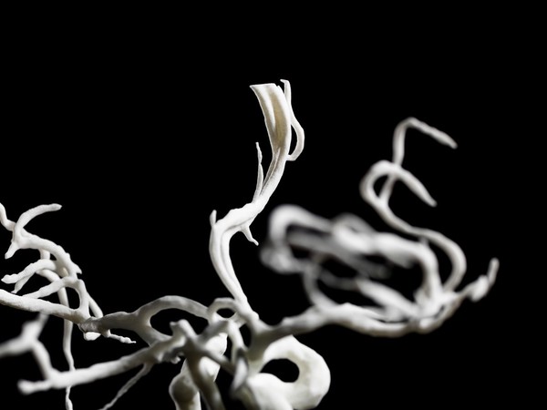 Brain blood vessels, suspected meningitis, 3D printed nylon