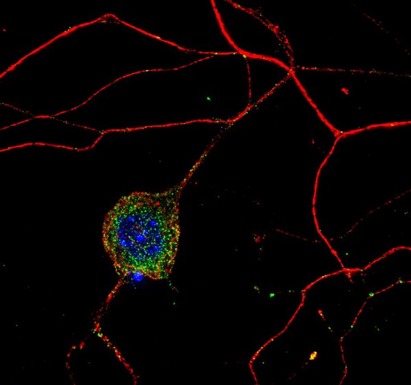 Dorsal root ganglion neurone from a mouse, LM