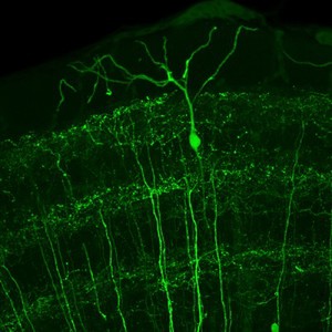 view Bipolar neurone in the midbrain of an adult zebrafish, LM