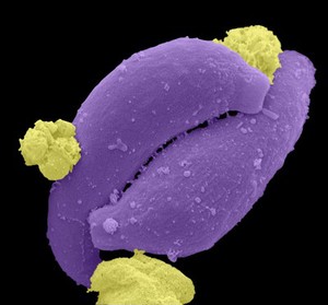 view Plasmodium ookinetes, malaria parasite life cycle, SEM