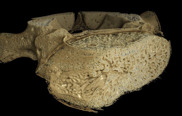 Single human T8 vertebra from infant at term, micro-CT