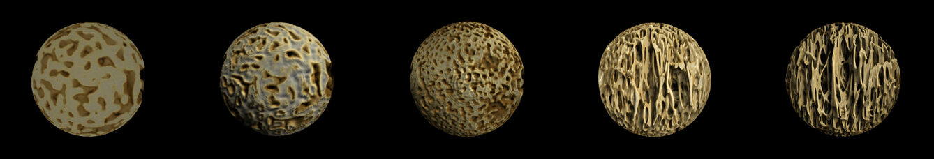 Bone development in human infant L1 vertebrae, micro-CT.