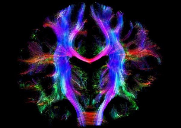 Healthy human brain from a young adult, tractography.