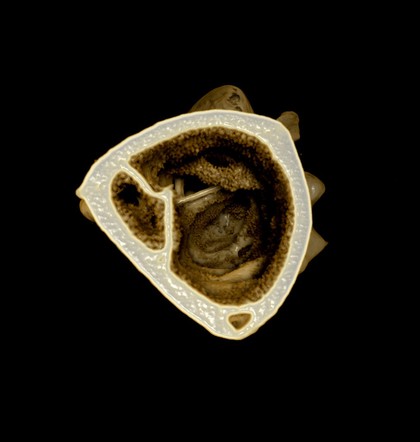 Thigh bone (femur) from a female Japanese quail, micro-CT