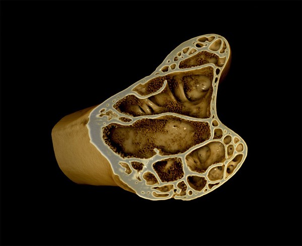 Thigh bone (femur) from a female Japanese quail, micro-CT