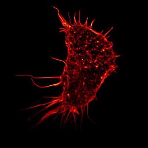 view Human kidney cell, Gated-STED microscopy